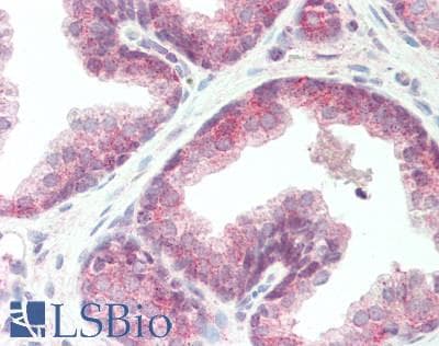 IHC-plus™ IL17RA Antibody