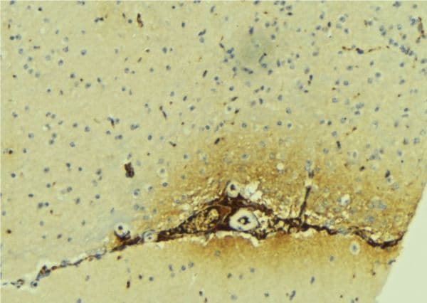 Polyclonal Rabbit anti-Human DFNA5 Antibody (IHC, IF, WB)