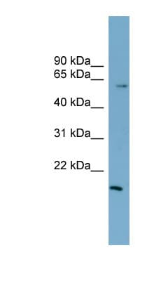 ZNF83 / HPF1 Antibody (N-Terminus)