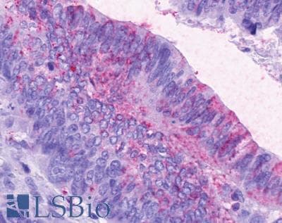 IHC-plus™ CCKAR / CCK1R Antibody (C-Terminus)