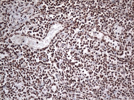 EWSR1 / EWS Antibody (aa256-447, clone OTI2G3)
