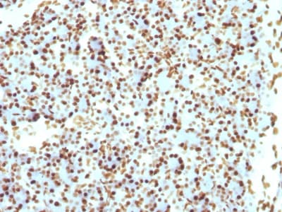 Histone H1 Antibody (clone r1415-1)