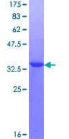 Human RBM3 Protein (Recombinant GST, N-terminus)