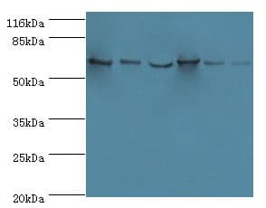 Polyclonal Rabbit anti-Human LCP1 / L-Plastin Antibody (aa2-627, IHC, WB)