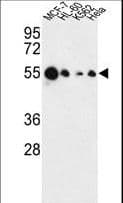 AIM2 Antibody (aa4-32)
