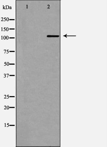 SKIV2L2 Antibody