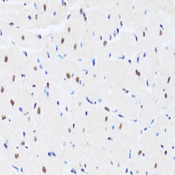 MTA3 Antibody