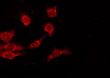 Polyclonal Rabbit anti-Human OR9A2 Antibody (IF, WB)