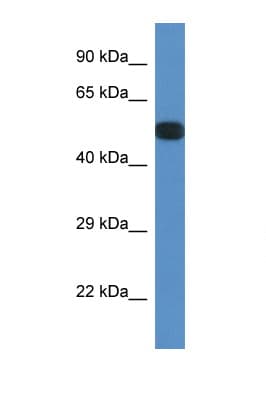 PPP2R5E Antibody (aa120-169)
