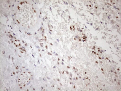 MGMT Antibody (clone OTI4F9)