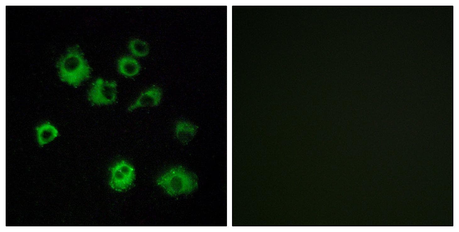 OX1R / Orexin Receptor 1 Antibody