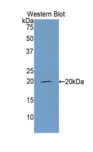 Properdin / CFP Antibody (aa315-469)