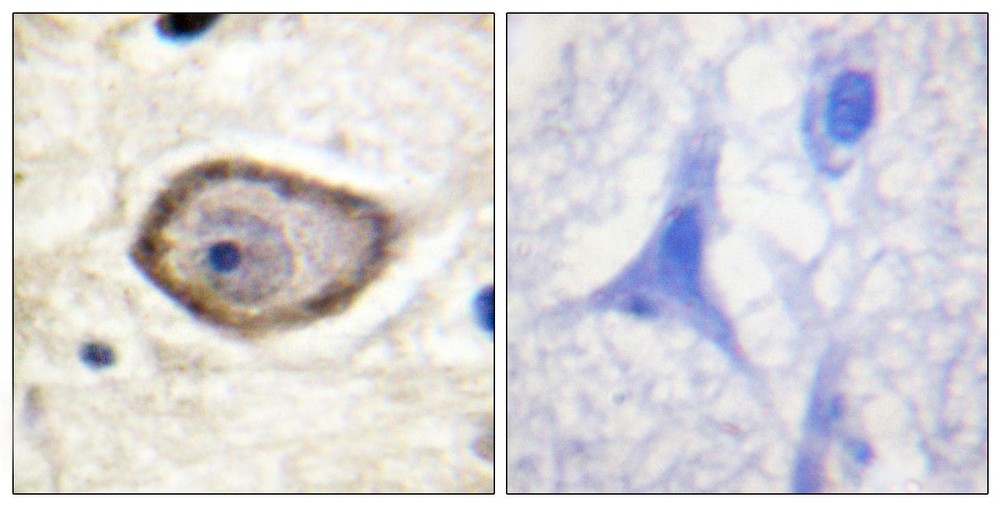 Polyclonal Rabbit anti-Human F3 / CD142 / Tissue factor Antibody (phospho-Ser290, IHC, WB)
