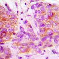 Polyclonal Rabbit anti-Human MARK2 Antibody (Internal, IHC, IF, WB)