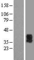 P2RY6 / P2Y6 Protein (Over-Expression Lysate Myc-DDK (Flag))