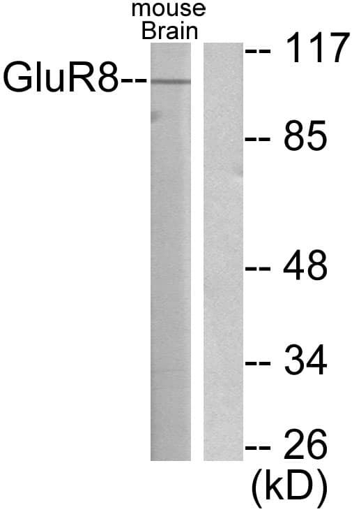 IHC-plus™ Polyclonal Rabbit anti-Human GRM8 / MGLUR8 Antibody (aa841-890, IHC, WB)