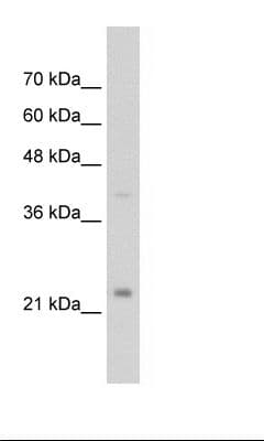 EMA / MUC1 Antibody (C-Terminus)