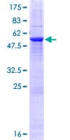 Human USE1 / p31 Protein (Recombinant GST)