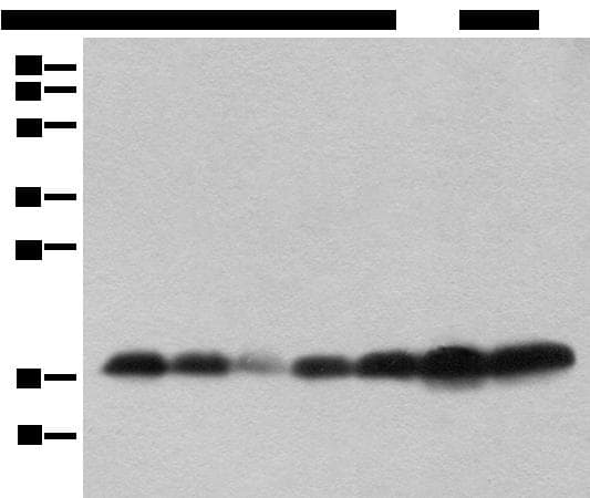 Polyclonal Rabbit anti-Human BUD31 Antibody (IHC, WB)