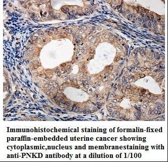 PNKD Antibody (aa164-342)