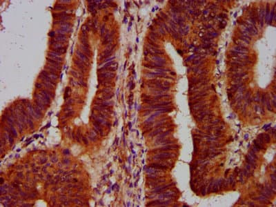 SLC5A5 / NIS Antibody