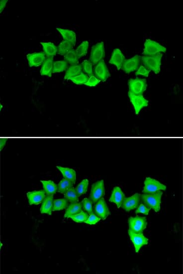 FKBP4 / FKBP52 Antibody