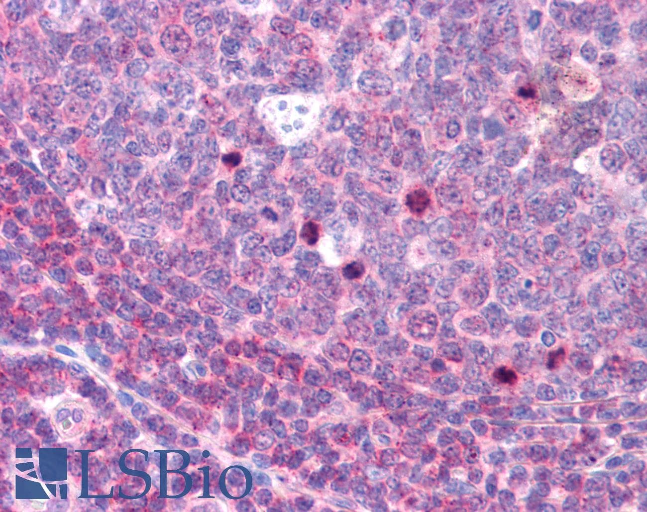 IHC-plus™ AURKB / Aurora-B Antibody (phospho-Thr232)