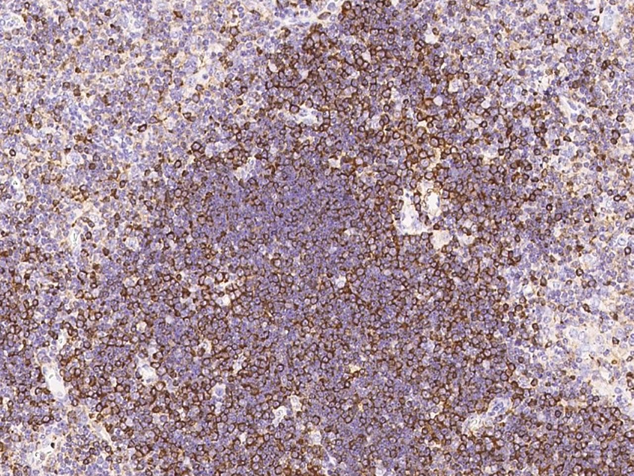 STMN1 / Stathmin / LAG Antibody (Preservative Free)