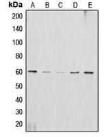 AKT2 Antibody (C-Terminus)