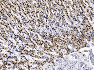AKR1B1 / Aldose Reductase Antibody