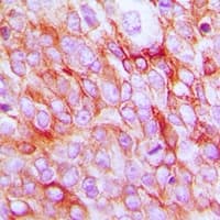 PTGER2 / EP2 Antibody (C-Terminus)