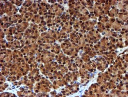 NQO2 Antibody (clone OTI3G4)