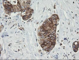 TAPBPL / TAPBPR Antibody (clone OTI4H5)