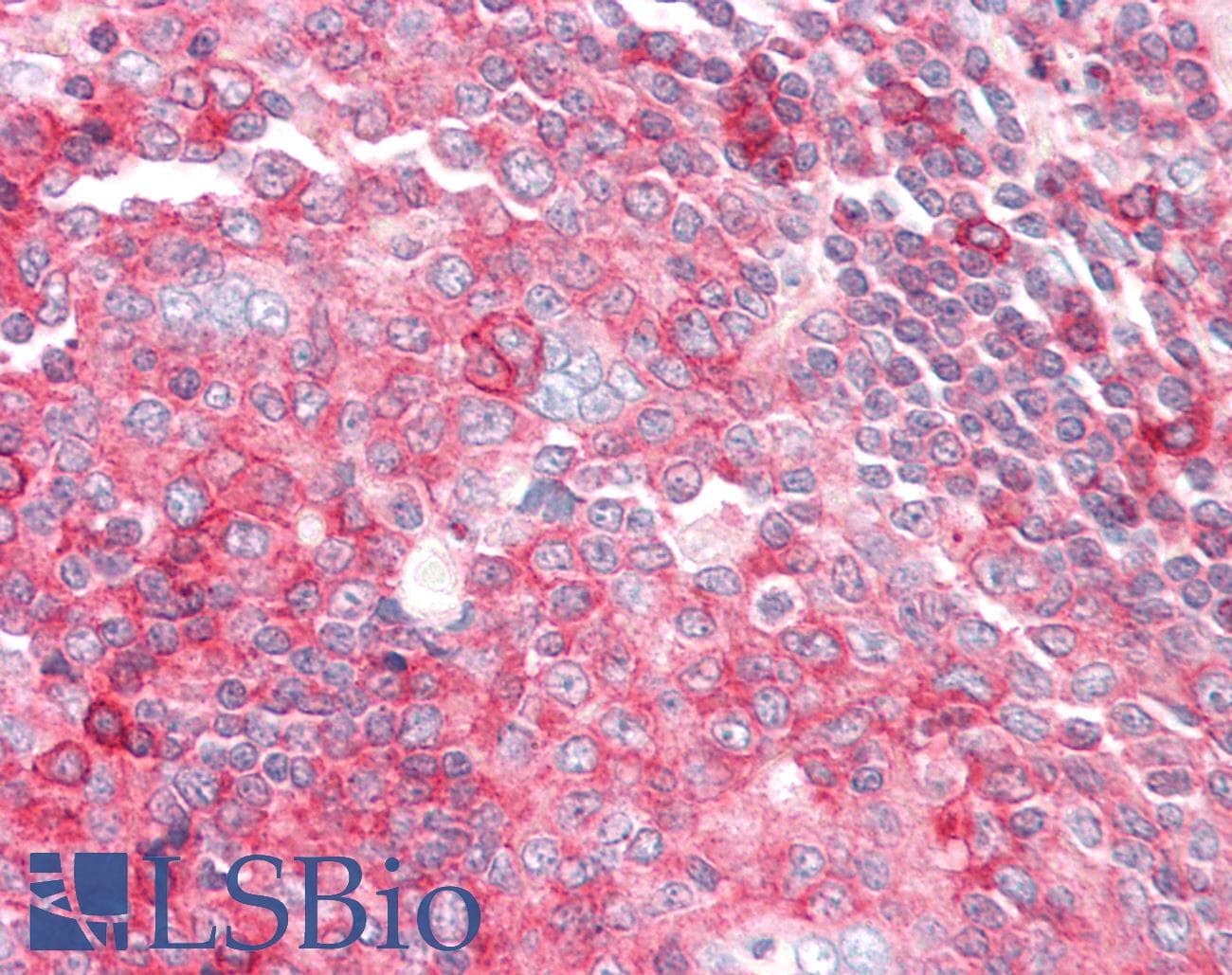 IHC-plus™ HLA-F Antibody