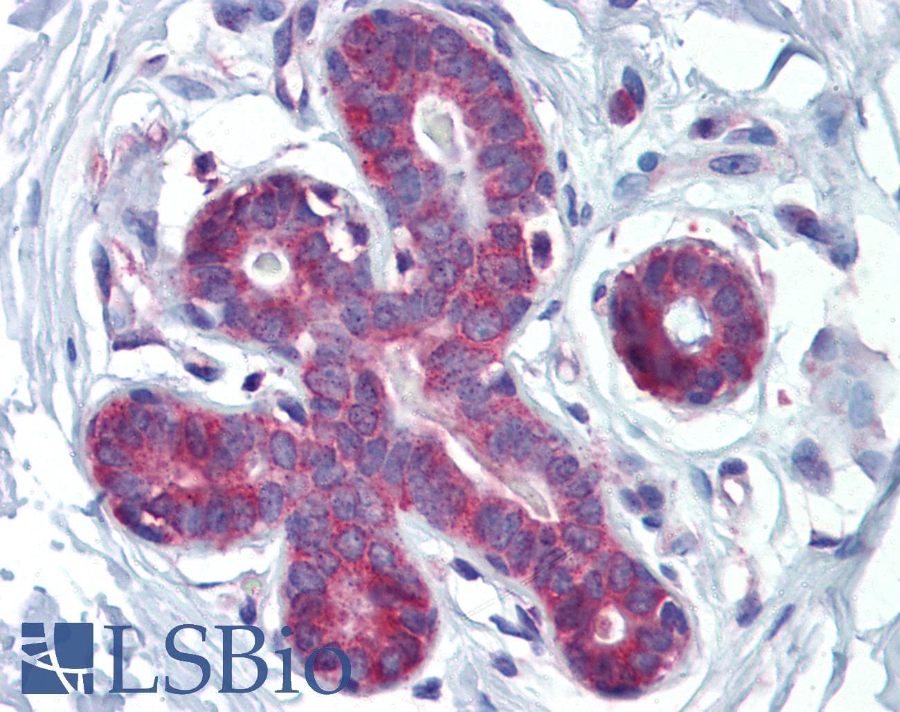 HOXA5 Antibody (C-Terminus)