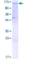 Human SF3A1 / SF3A120 Protein (Recombinant GST)