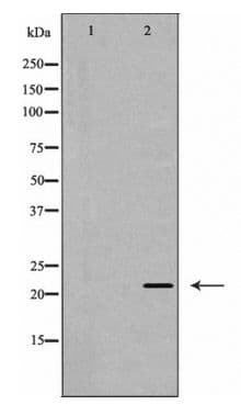 IGF1 Antibody