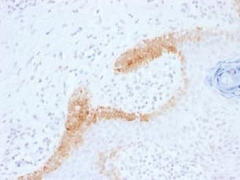Monoclonal Mouse anti-Human KRT15 / CK15 / Cytokeratin 15 Antibody (clone KRT15/1699, IHC, IF, WB)