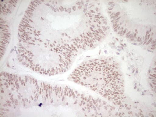 DVL2 / Dishevelled 2 Antibody (aa1-320, clone OTI2D11)