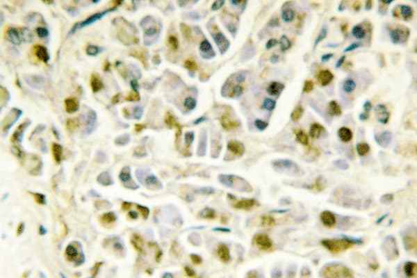 RAD51B Antibody (Gly226)