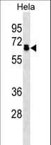 PPP2R5D Antibody (aa63-91)