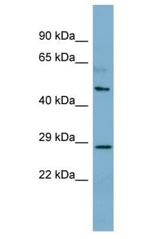 CNGA4 Antibody (aa128-177)