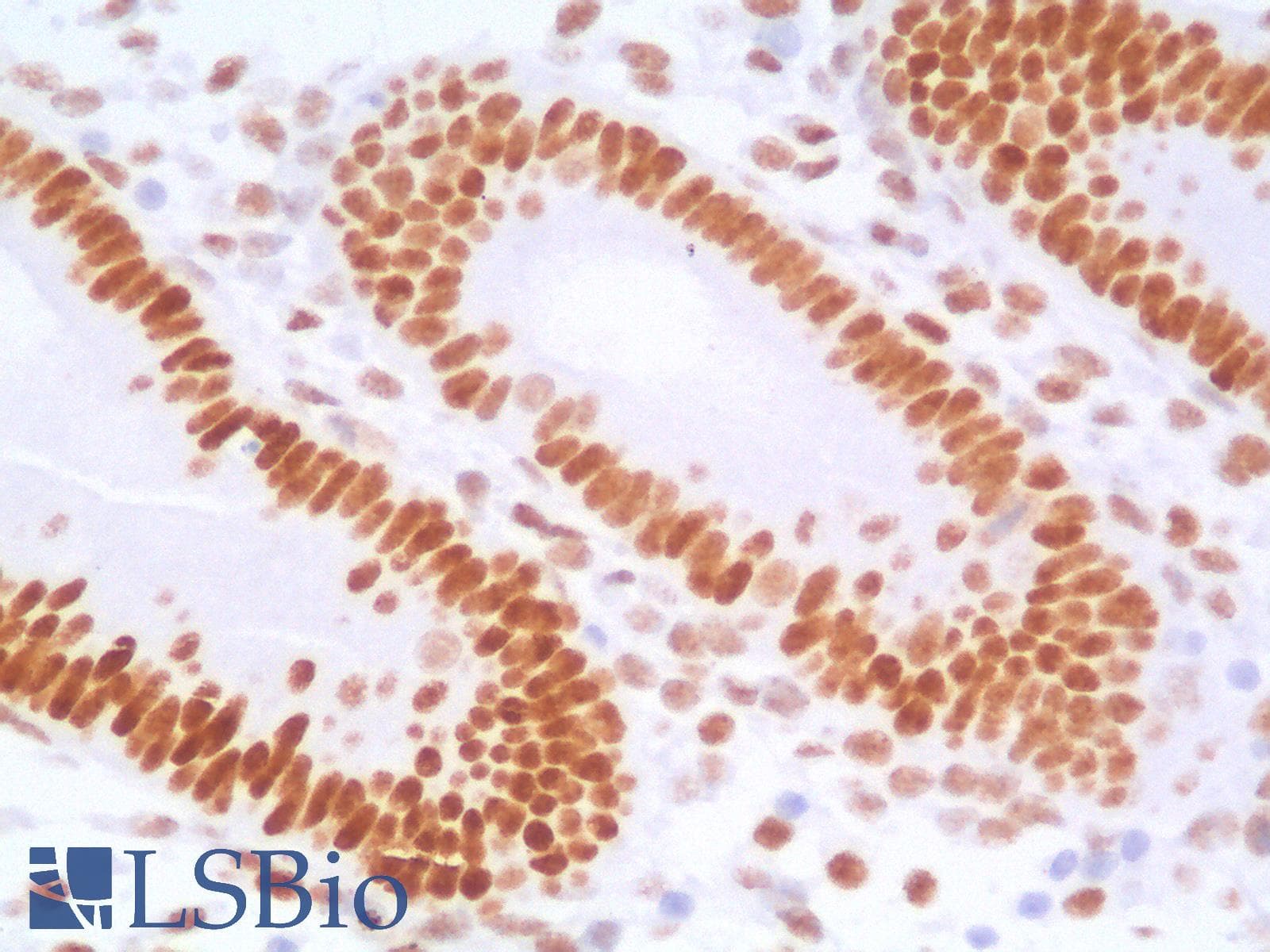PathPlus™ TLE1 / TLE 1 Antibody (aa 175-338, clone TLE1/2946R)