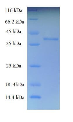 Human THAP6 Protein (Recombinant His-SUMO)
