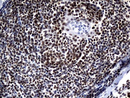 Monoclonal Mouse anti-Human ZHX2 / RAF Antibody (clone OTI2E11, aa595-837, IHC, WB)
