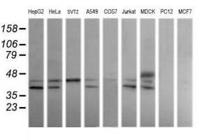 MAP2K3 / MEK3 / MKK3 Antibody (clone OTI5G5)