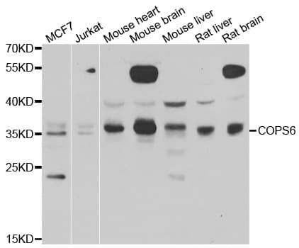 COPS6 / CSN6 Antibody