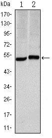 CA9 / Carbonic Anhydrase IX Antibody (clone 2D3)