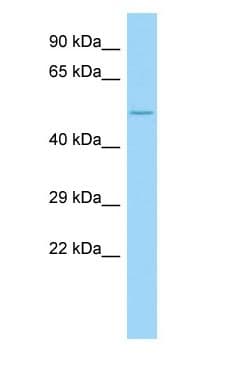 Polyclonal Rabbit anti-Human COL23A1 / Collagen XXIII Antibody (aa460-509, WB)