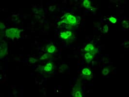 PME-1 / PPME1 Antibody (clone OTI7F12)